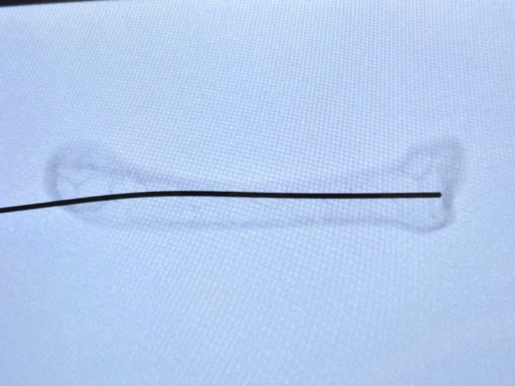 K-wire X-ray
